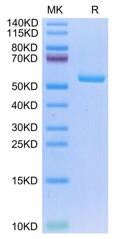 Human HLA-A*02:01&B2M&NY-ESO-1 (SLLMWITQV) Monomer on Tris-Bis PAGE under reduced condition. The purity is greater than 95%.Recombinant Human HLA-A*02:01&B2M&NY-ESO-1 (SLLMWITQV) Monomer Protein, Active