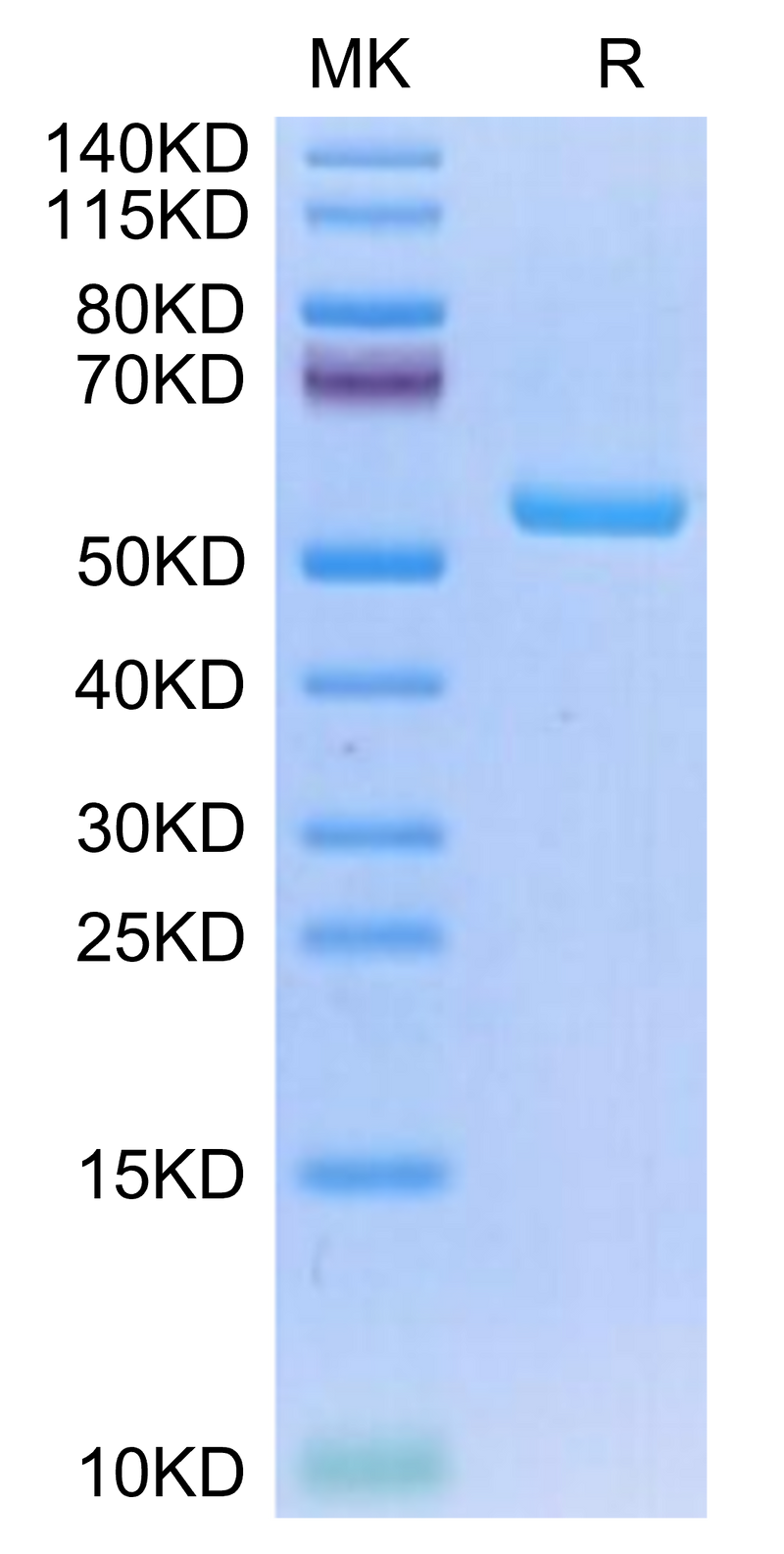 Human HLA-A*02:01&B2M&NY-ESO-1 (SLLMWITQV) Monomer on Tris-Bis PAGE under reduced condition. The purity is greater than 95%.Recombinant Human HLA-A*02:01&B2M&NY-ESO-1 (SLLMWITQV) Monomer Protein, Active