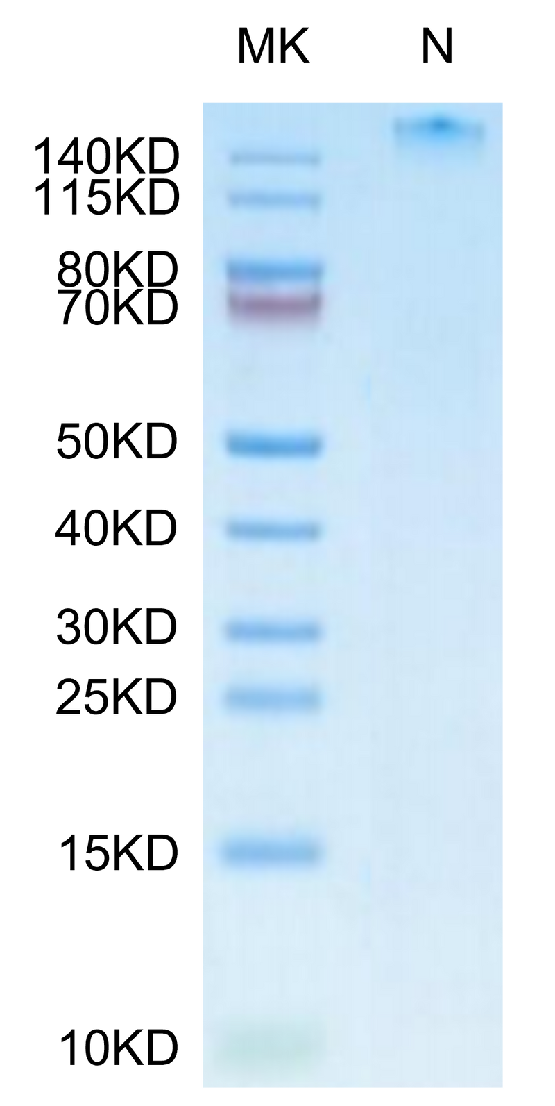 Human HLA-A*11:01&B2M&LMP2 (SSCSSCPLTK) Tetramer on Tris-Bis PAGE under Non reducing (N) condition. The purity is greater than 95%.Recombinant Human HLA-A*11:01&B2M&LMP2 (SSCSSCPLTK) Tetramer Protein