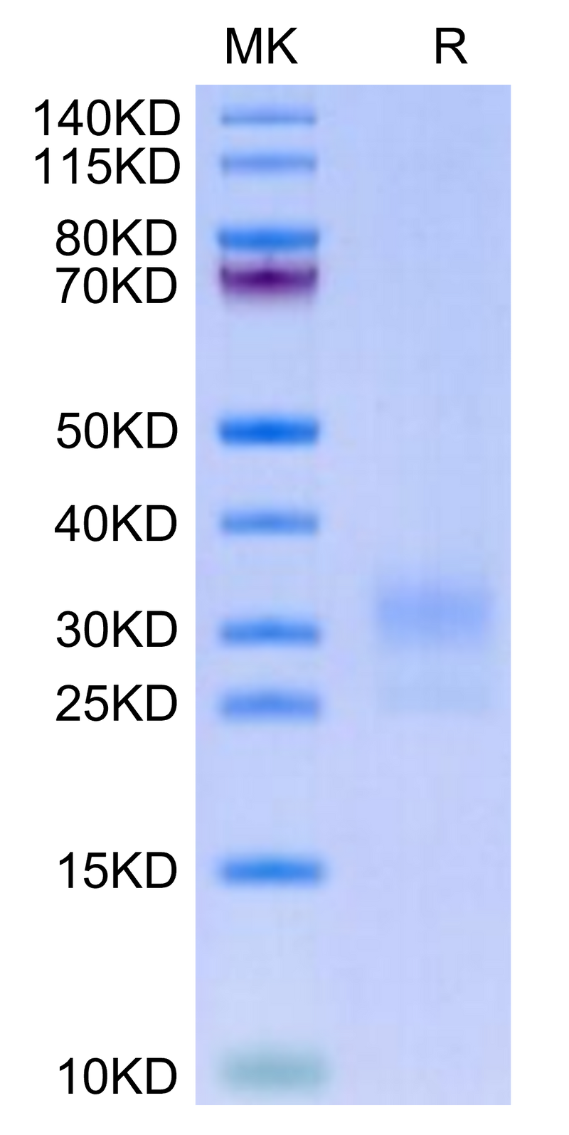 Biotinylated Human LAIR1 on Tris-Bis PAGE under reduced condition. The purity is greater than 95%.Biotinylated Human LAIR1/CD305 Protein, Active
