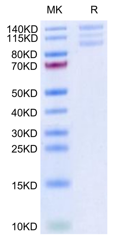 Biotinylated Human ITGAV&ITGB6 on Tris-Bis PAGE under reduced condition. The purity is greater than 95%.Biotinylated Human Integrin alpha V beta 6 (ITGAV&ITGB6) Heterodimer Protein, Active