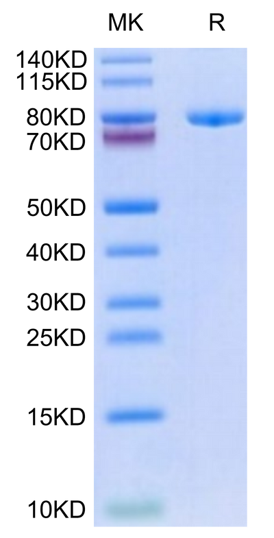 Biotinylated Human Transferrin R on Tris-Bis PAGE under reduced condition. The purity is greater than 95%.Biotinylated Human Transferrin R/CD71 Protein, Active
