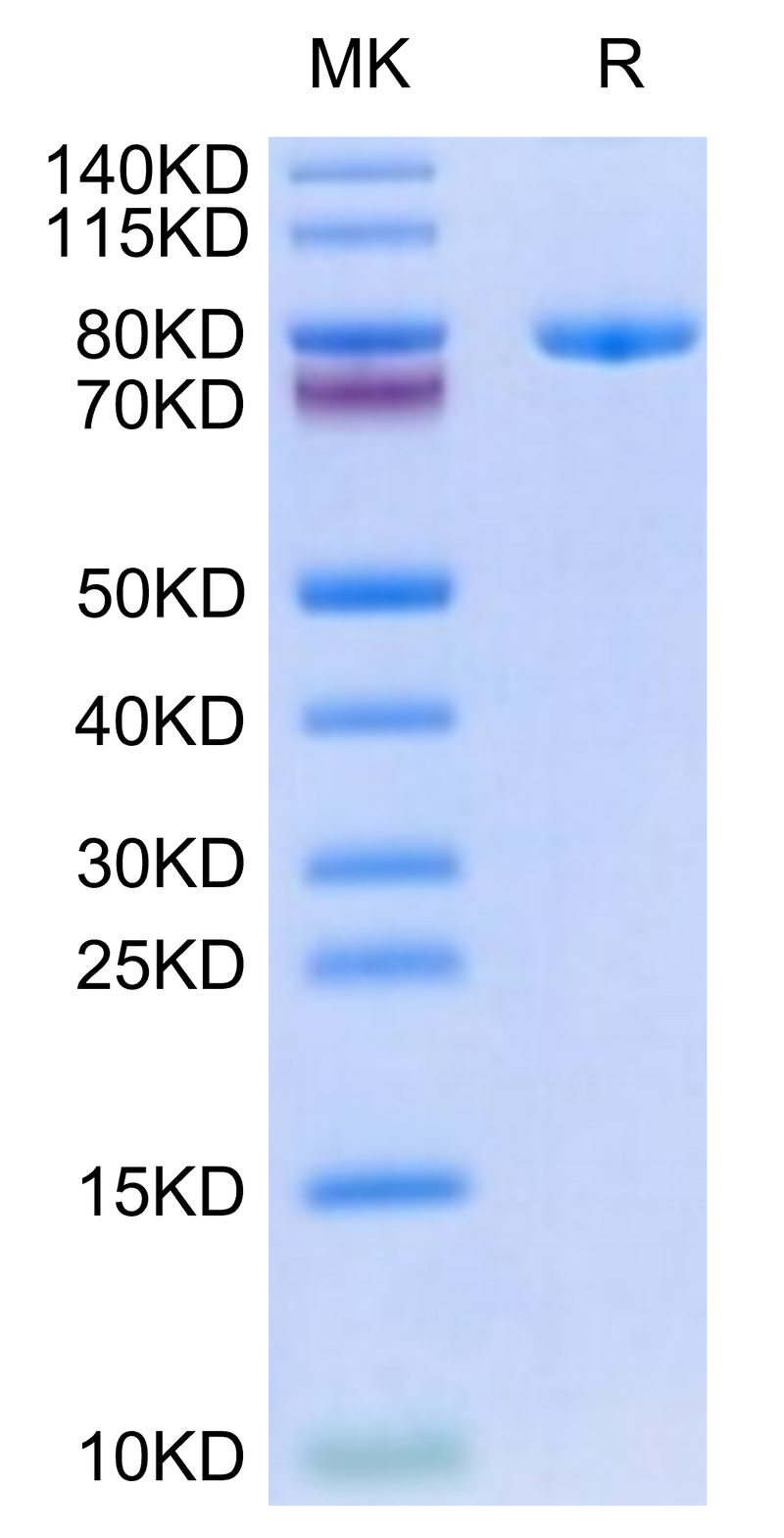 Biotinylated Human Transferrin R on Tris-Bis PAGE under reduced condition. The purity is greater than 95%.Biotinylated Human Transferrin R/CD71 Protein, Active