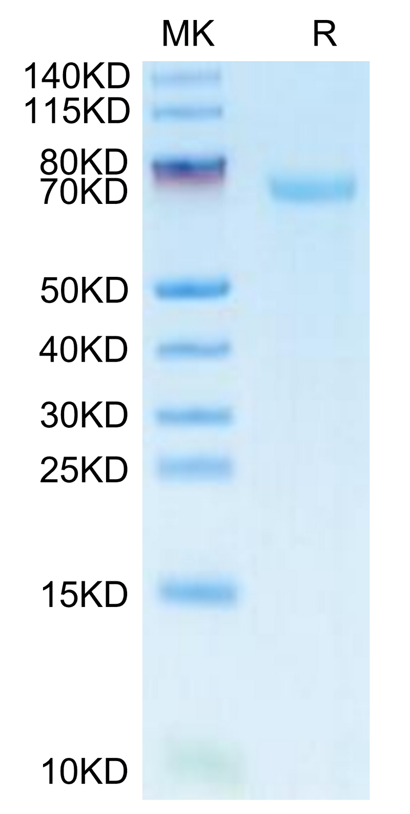 FITC-Labeled Human B7-H3 on Tris-Bis PAGE under reduced condition. The purity is greater than 95%.Recombinant FITC-Labeled Human B7-H3/CD276 Protein