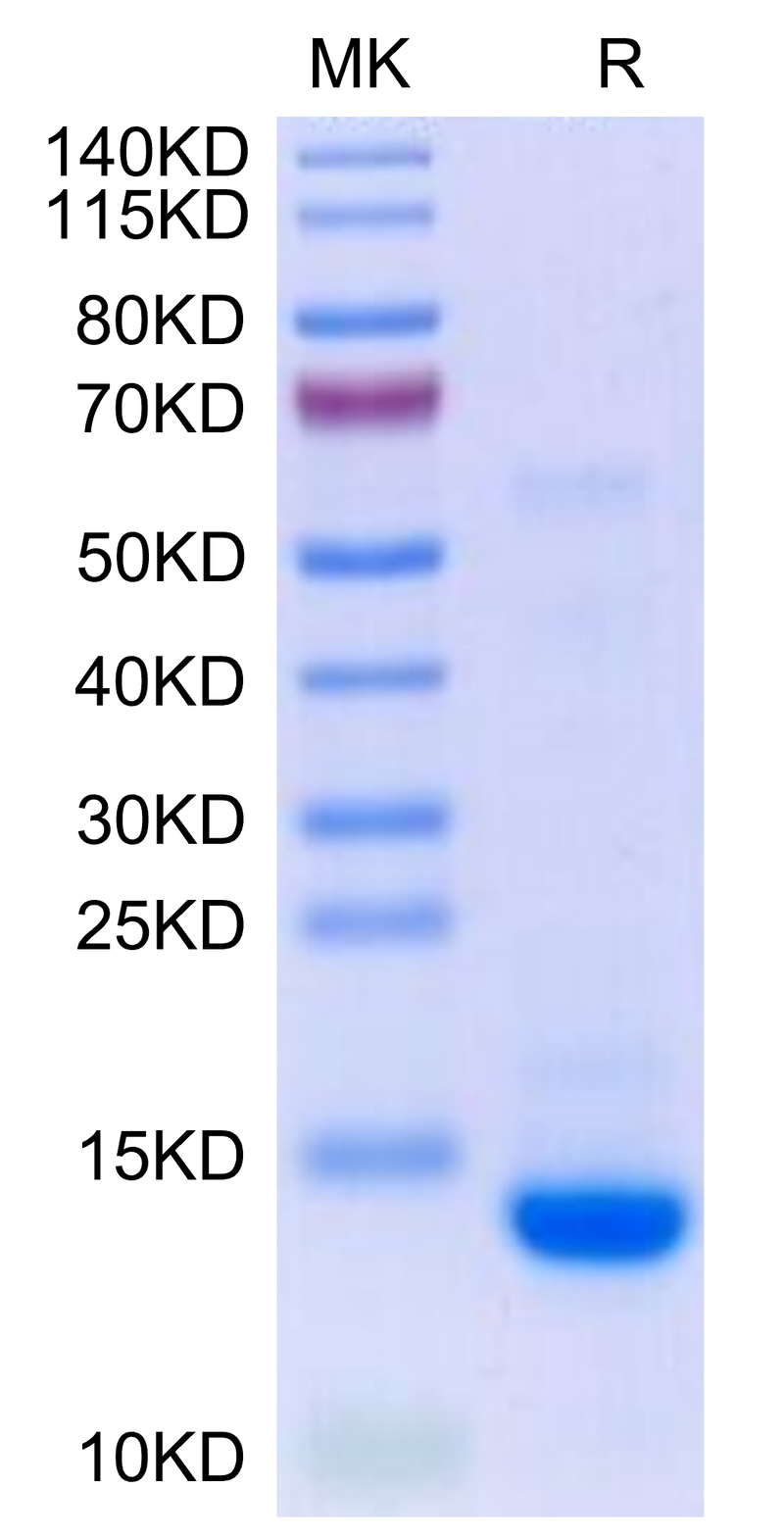 Biotinylated Human Mature TGF beta 2 on Tris-Bis PAGE under reduced condition. The purity is greater than 95%.Biotinylated Human Mature TGF beta 2 Protein, Active