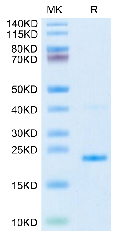 Mouse IL-17B on Tris-Bis PAGE under reduced condition. The purity is greater than 95%.Recombinant Mouse IL-17B Protein