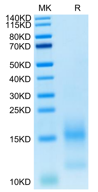 FITC-Labeled Human BCMA on Tris-Bis PAGE under reduced condition. The purity is greater than 95%.Recombinant FITC-Labeled Human BCMA/TNFRSF17 Protein