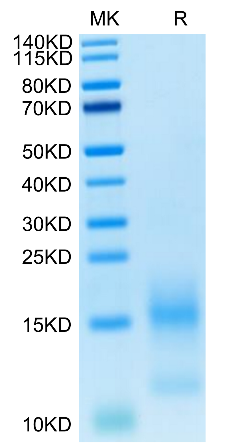 FITC-Labeled Human BCMA on Tris-Bis PAGE under reduced condition. The purity is greater than 95%.Recombinant FITC-Labeled Human BCMA/TNFRSF17 Protein