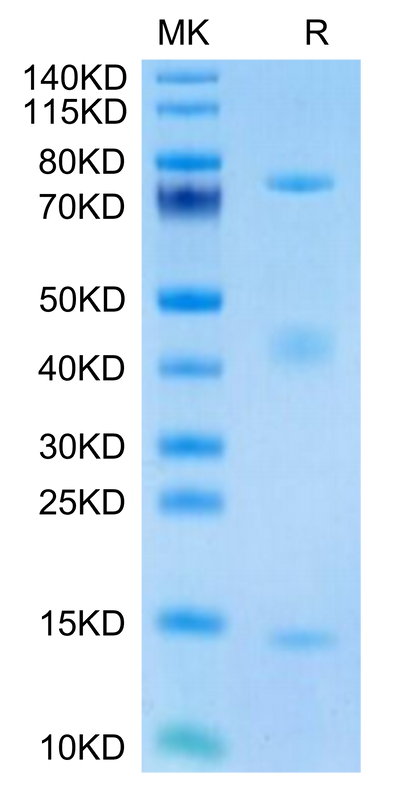 Biotinylated Rat GARP&Latent TGF Beta 1 Complex on Tris-Bis PAGE under reduced condition. The purity is greater than 95%.Biotinylated Rat GARP&Latent TGF Beta 1 Complex Protein, Active