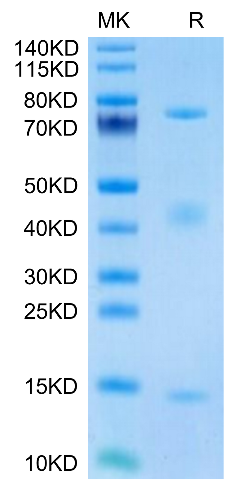 Biotinylated Rat GARP&Latent TGF Beta 1 Complex on Tris-Bis PAGE under reduced condition. The purity is greater than 95%.Biotinylated Rat GARP&Latent TGF Beta 1 Complex Protein, Active