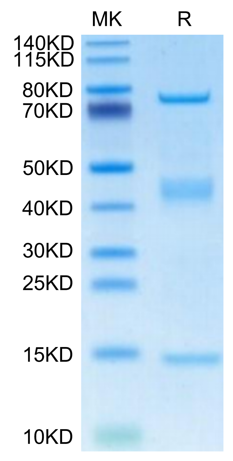 Rat GARP&Latent TGF Beta 1 Complex on Tris-Bis PAGE under reduced condition. The purity is greater than 95%.Recombinant Rat GARP&Latent TGF Beta 1 Complex Protein, Active