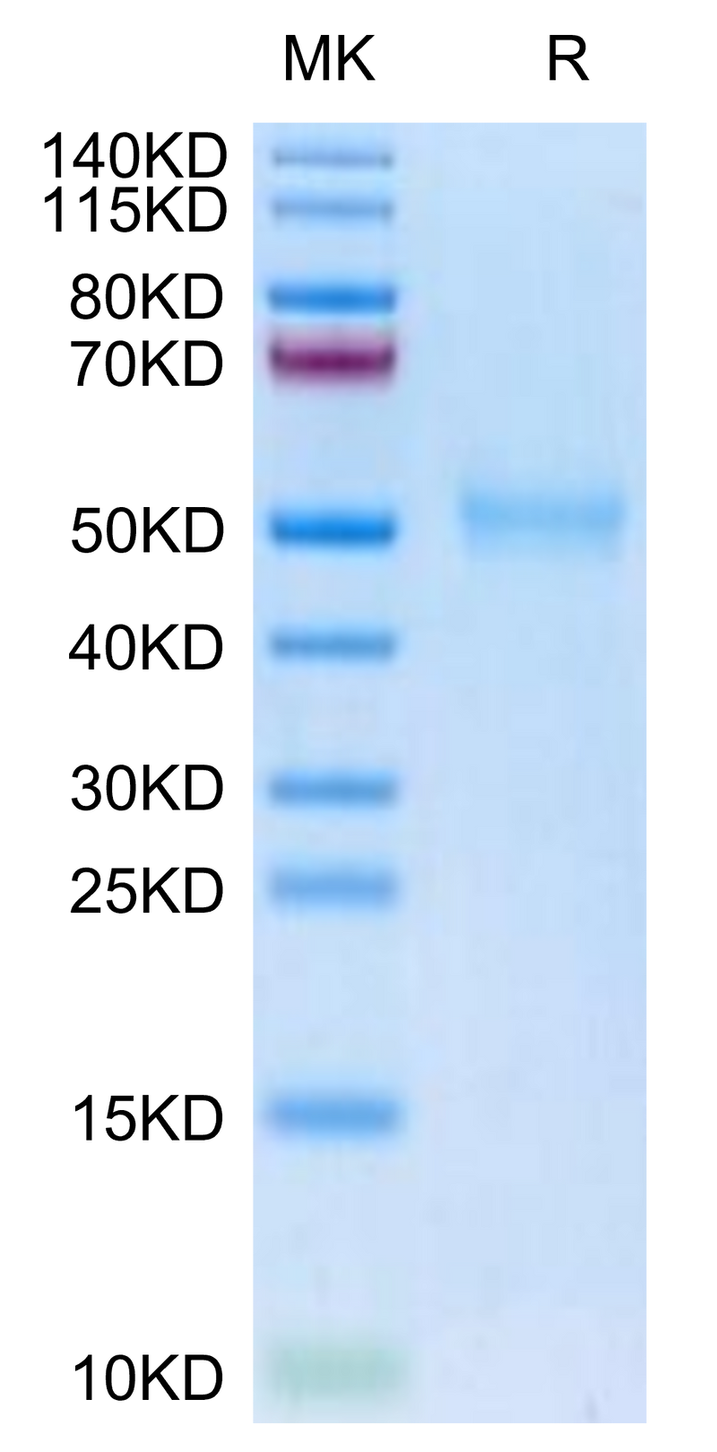 Biotinylated Human TGFBR1 on Tris-Bis PAGE under reduced condition. The purity is greater than 95%.Biotinylated Human TGFBR1 Protein