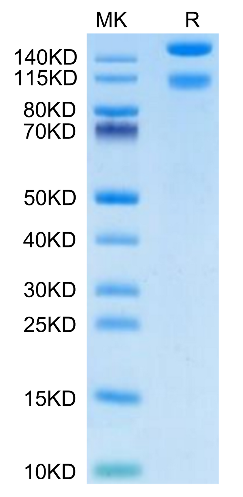 Mouse ITGA1&ITGB1 on Tris-Bis PAGE under reduced condition. The purity is greater than 95%.Recombinant Mouse Integrin alpha 1 beta 1 (ITGA1&ITGB1) Heterodimer Protein