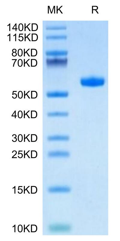 Human HLA-A*01:01&B2M&MAGE-A3 (EVDPIGHLY) Monomer on Tris-Bis PAGE under reduced condition. The purity is greater than 95%.Recombinant Human HLA-A*01:01&B2M&MAGE-A3 (EVDPIGHLY) Monomer Protein
