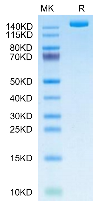 SARS-COV-2 Spike S (B.1.640.2/IHU) Trimer on Tris-Bis PAGE under reduced condition. The purity is greater than 95%.Recombinant SARS-COV-2 Spike S (B.1.640.2/IHU) Trimer Protein, Active