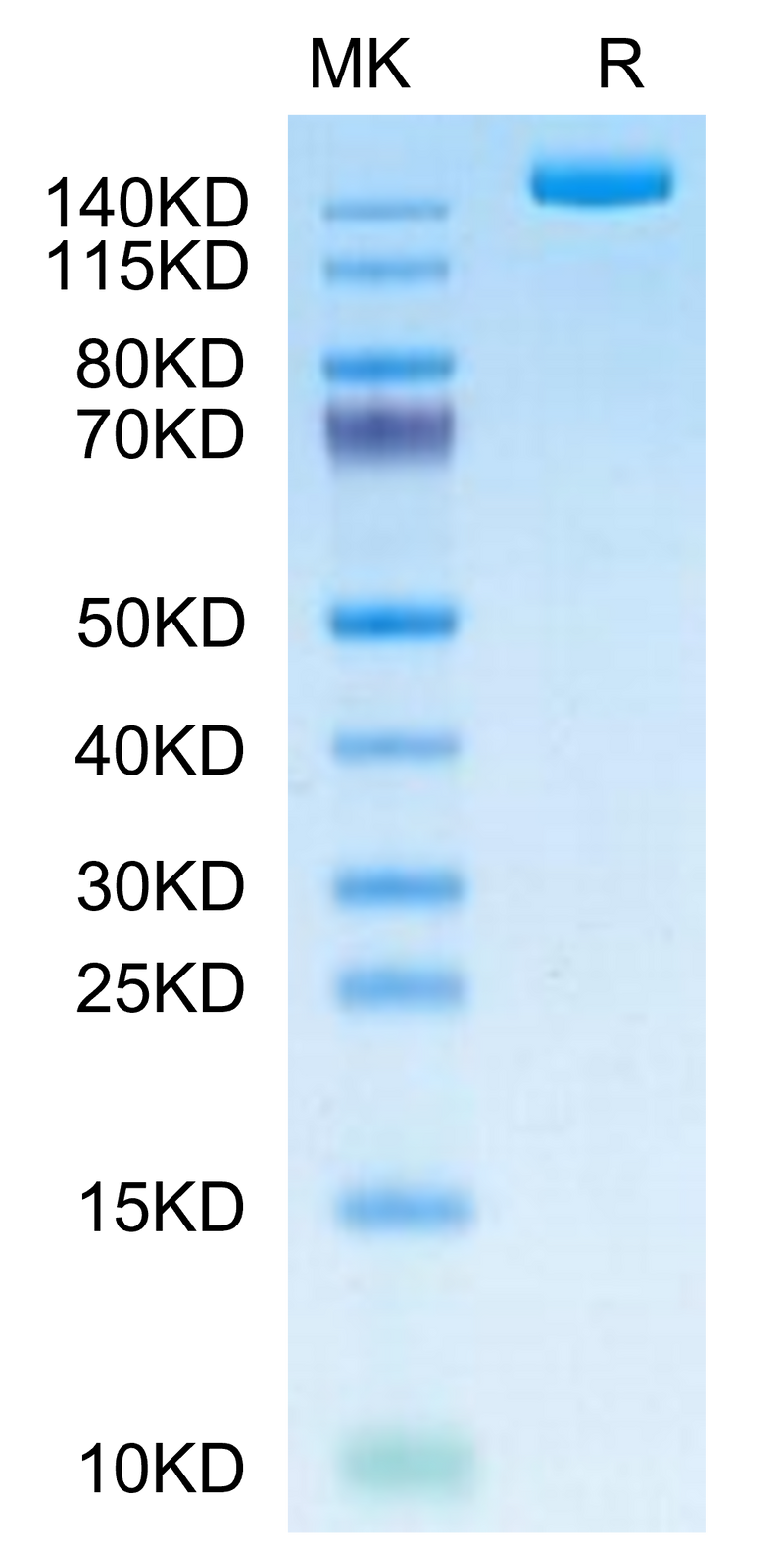 SARS-COV-2 Spike S (B.1.640.2/IHU) Trimer on Tris-Bis PAGE under reduced condition. The purity is greater than 95%.Recombinant SARS-COV-2 Spike S (B.1.640.2/IHU) Trimer Protein, Active