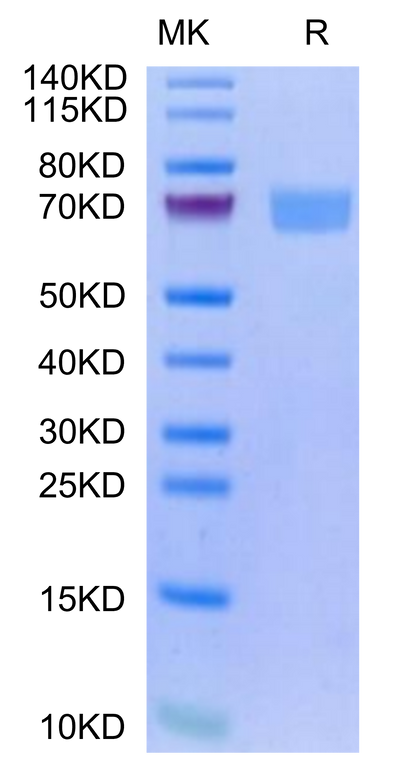 Human IL-22R alpha 1&IL-10R beta on Tris-Bis PAGE under reduced condition. The purity is greater than 95%.Recombinant Human IL-22R alpha 1&IL-10R beta Protein, Active