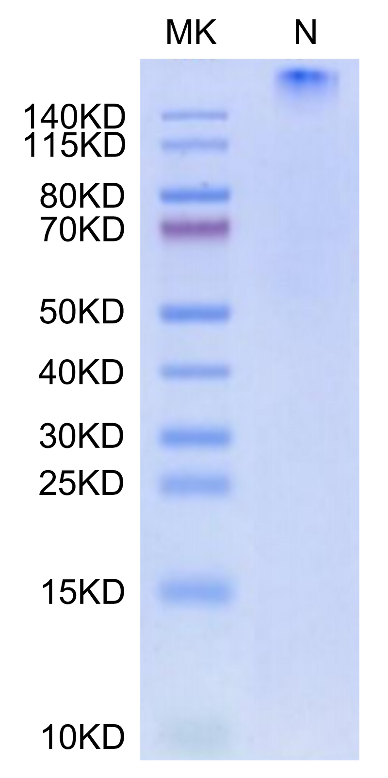 Human HLA-A*01:01&B2M&CT83 (NTDNNLAVY) Tetramer on Tris-Bis PAGE under Non reducing (N) condition. The purity is greater than 95%.Recombinant Human HLA-A*01:01&B2M&CT83 (NTDNNLAVY) Tetramer Protein
