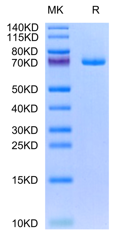 Human GAS6 on Tris-Bis PAGE under reduced condition. The purity is greater than 95%.Recombinant Human GAS6 Protein, Active