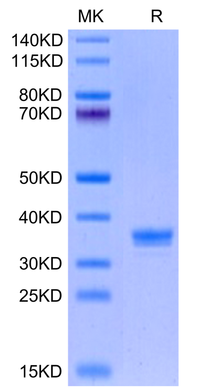 Mouse ANTXR2 on Tris-Bis PAGE under reduced condition. The purity is greater than 95%.Recombinant Mouse ANTXR2 Protein