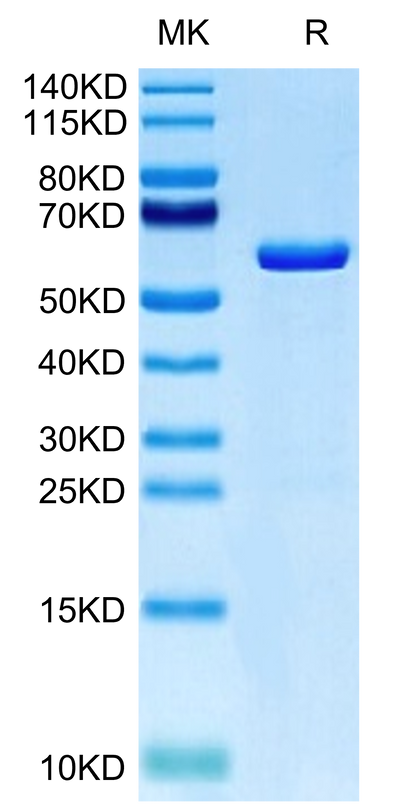 Human TRAIL Trimer on Tris-Bis PAGE under reduced condition. The purity is greater than 95%.Recombinant Human TRAIL Trimer Protein, Active