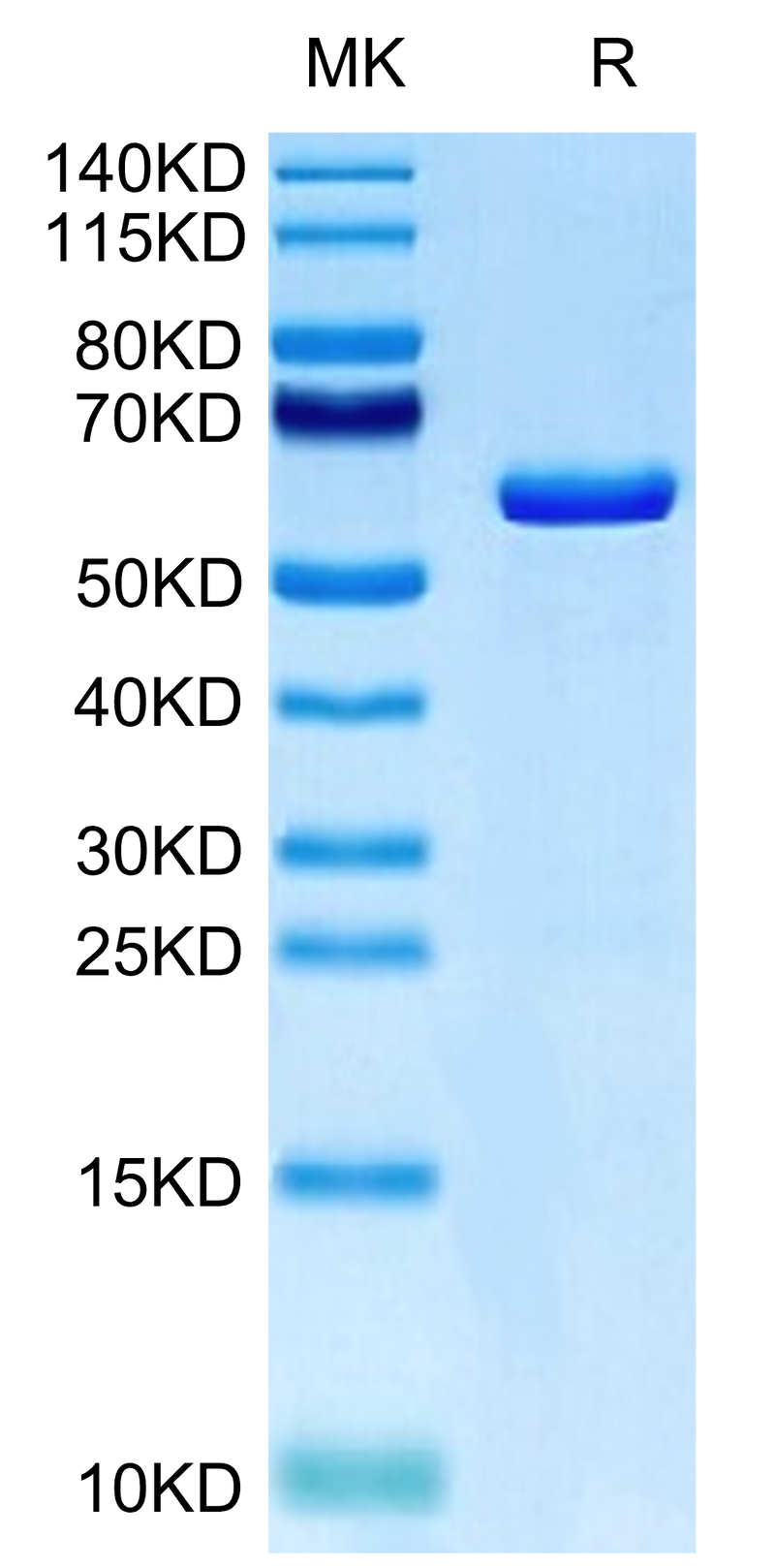 Human TRAIL Trimer on Tris-Bis PAGE under reduced condition. The purity is greater than 95%.Recombinant Human TRAIL Trimer Protein, Active
