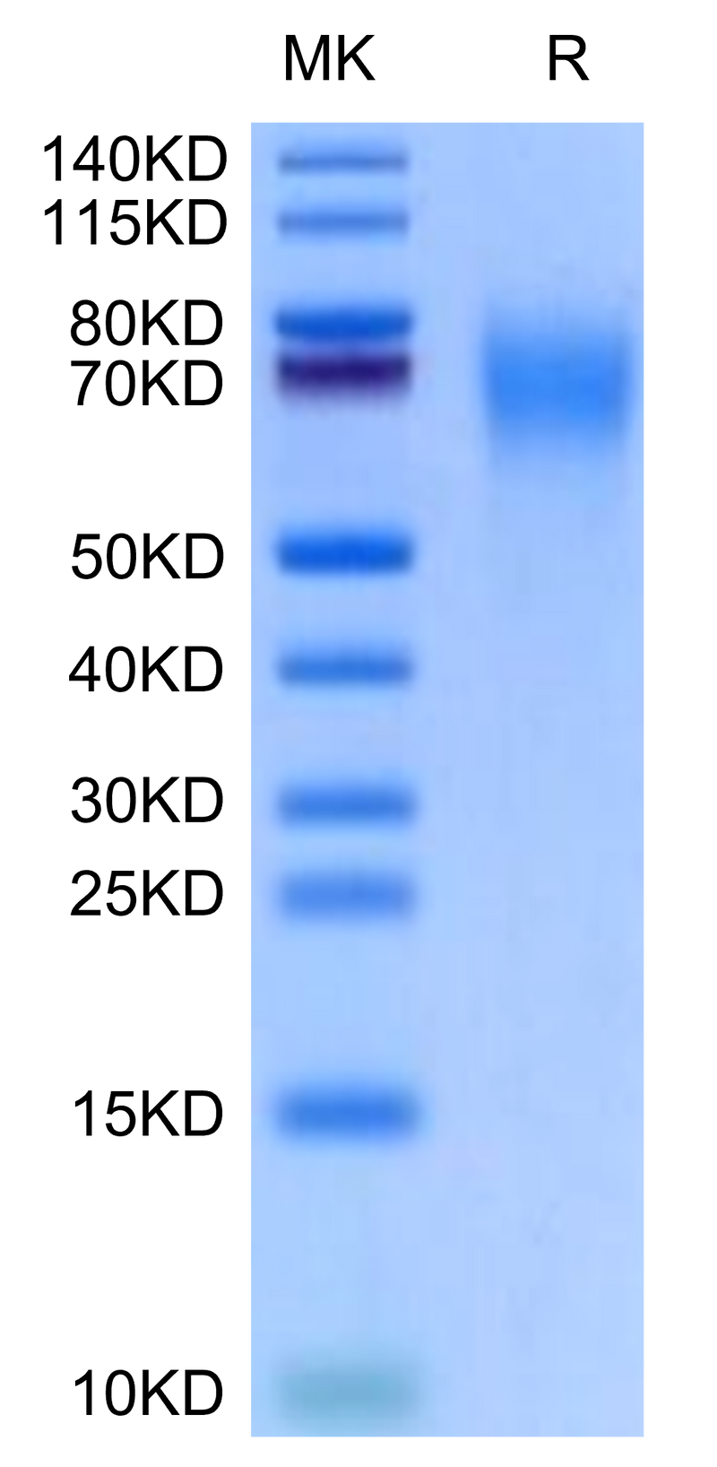 Cynomolgus CD200 R1 on Tris-Bis PAGE under reduced condition. The purity is greater than 95%.Recombinant Cynomolgus CD200 R1/CRTR2 Protein, Active