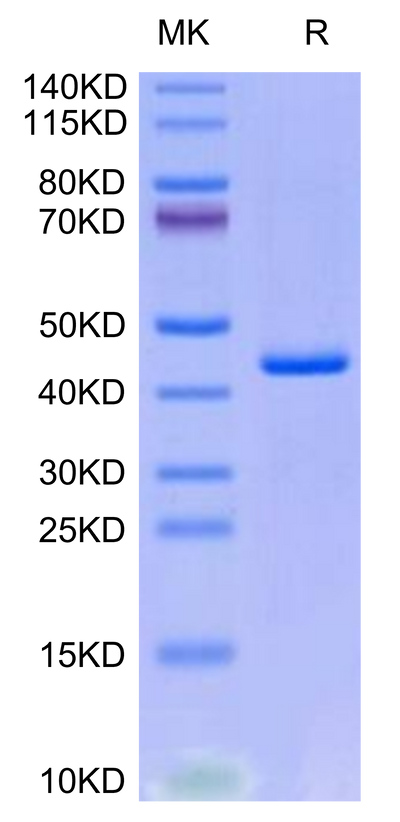 Human CXCL4L1 on Tris-Bis PAGE under reduced condition. The purity is greater than 95%.Recombinant Human CXCL4L1 Protein