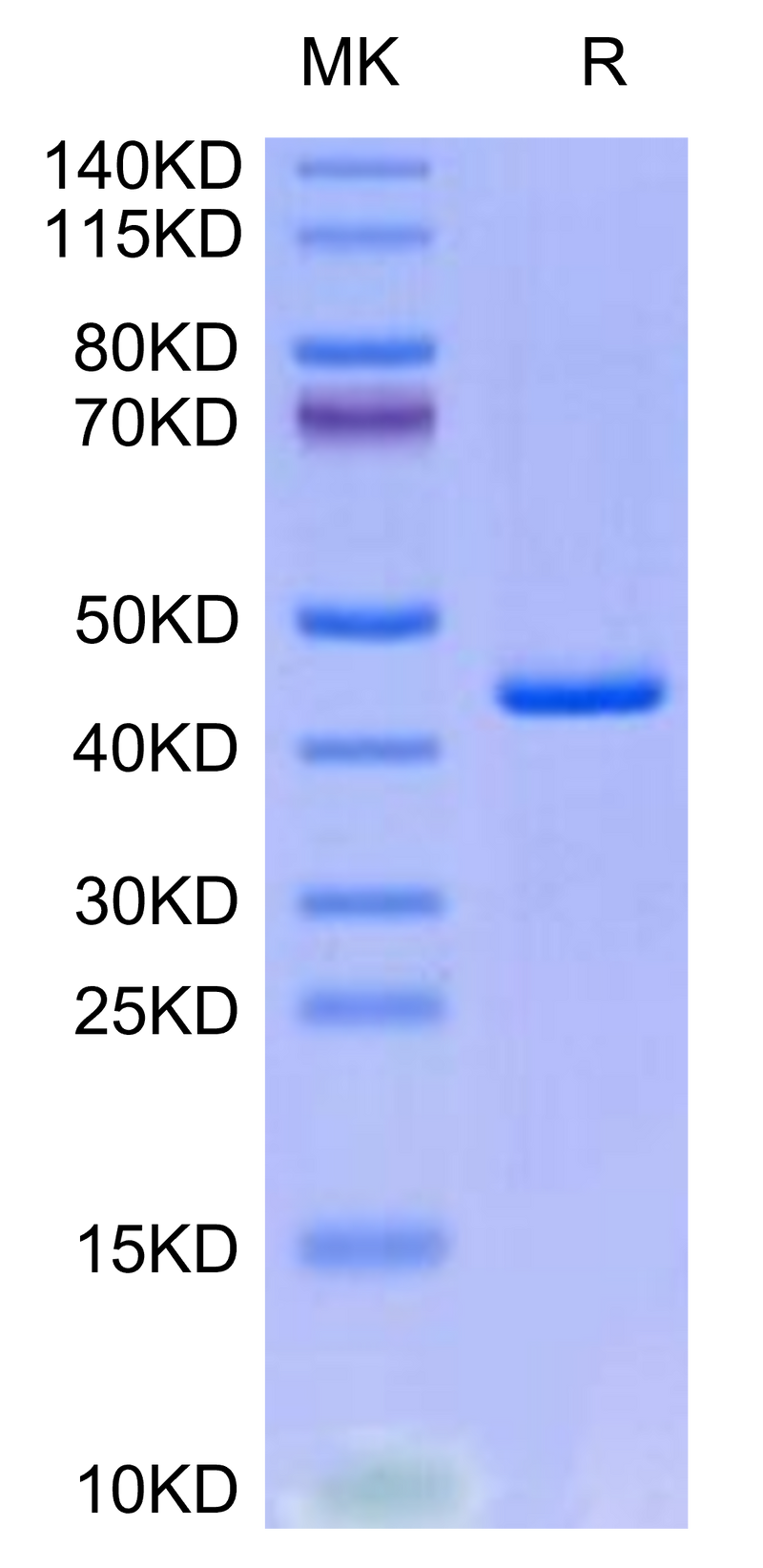Human CXCL4L1 on Tris-Bis PAGE under reduced condition. The purity is greater than 95%.Recombinant Human CXCL4L1 Protein