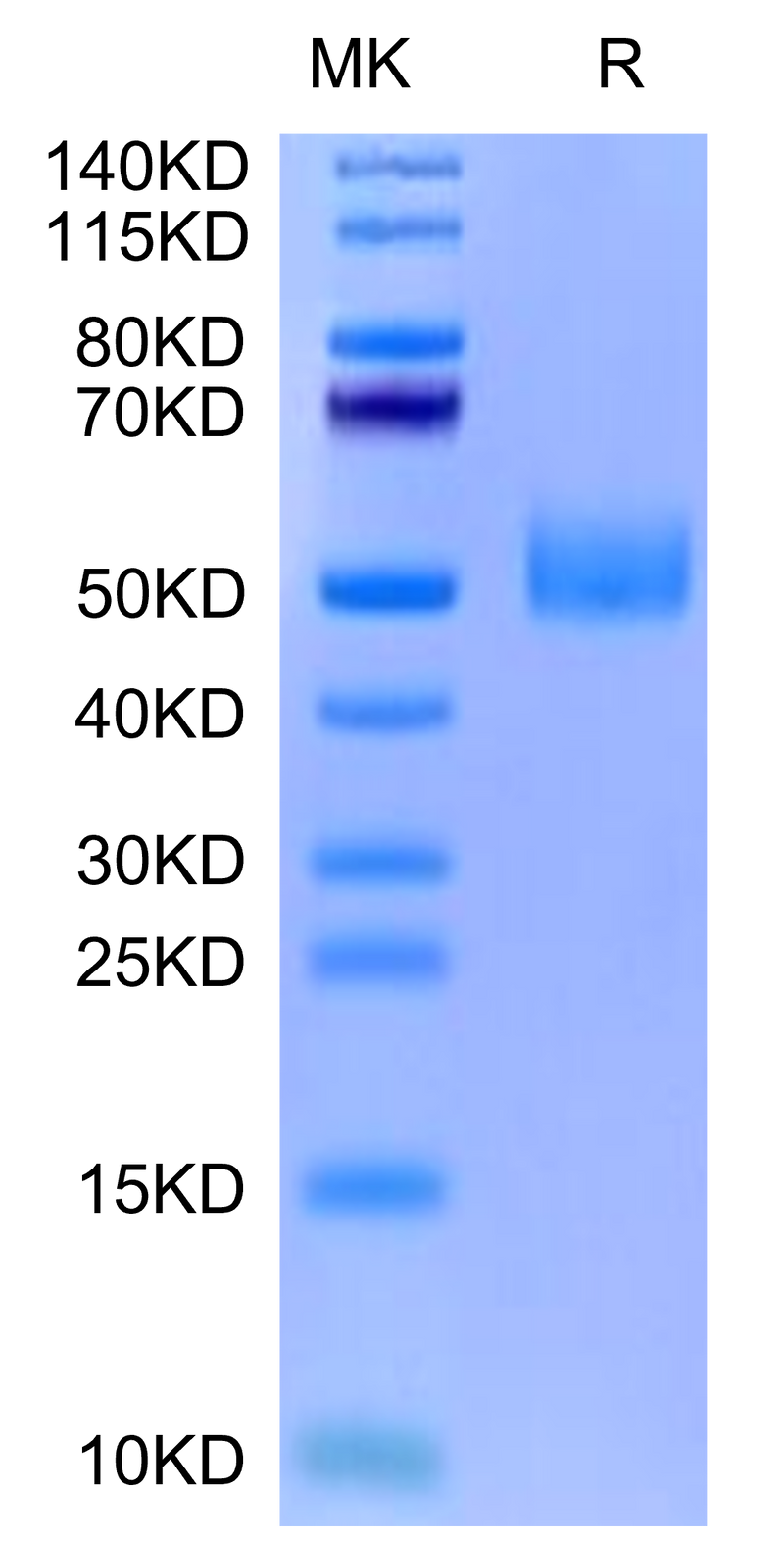 Biotinylated Mouse GFRAL on Tris-Bis PAGE under reduced condition. The purity is greater than 95%.Biotinylated Mouse GFRAL/GFR alpha-like Protein, Active