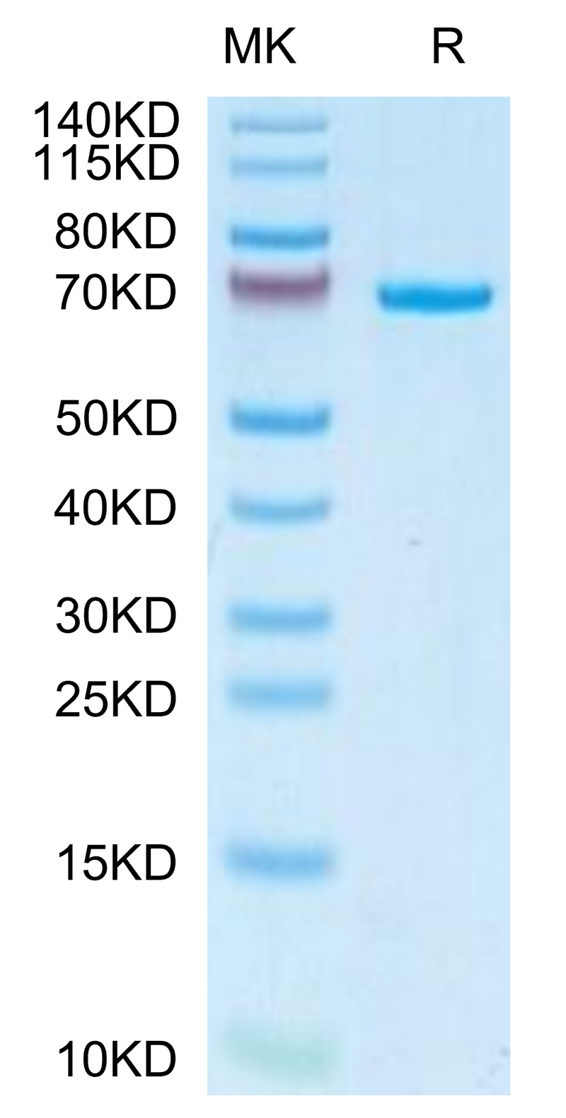 Canine AFP on Tris-Bis PAGE under reduced condition. The purity is greater than 95%.Recombinant Canine AFP Protein