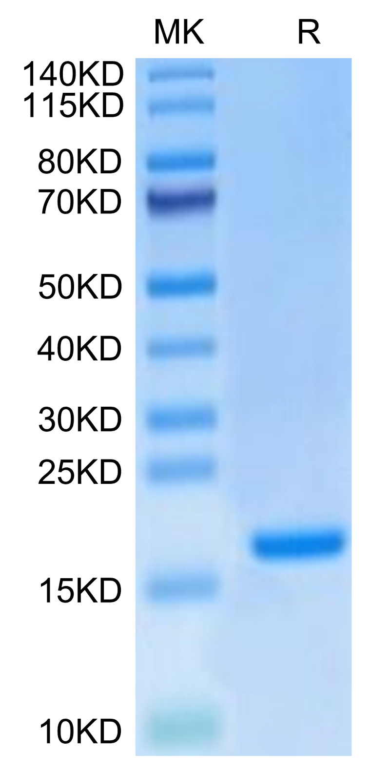 Mouse IL-20 on Tris-Bis PAGE under reduced condition. The purity is greater than 95%.Recombinant Mouse IL-20 Protein