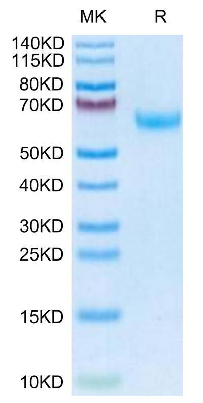 Mouse DDR2 on Tris-Bis PAGE under reduced condition. The purity is greater than 95%.Recombinant Mouse DDR2 Protein