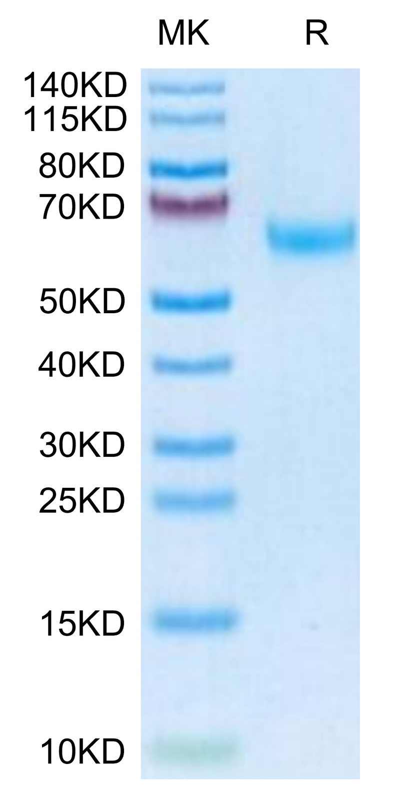 Mouse DDR2 on Tris-Bis PAGE under reduced condition. The purity is greater than 95%.Recombinant Mouse DDR2 Protein