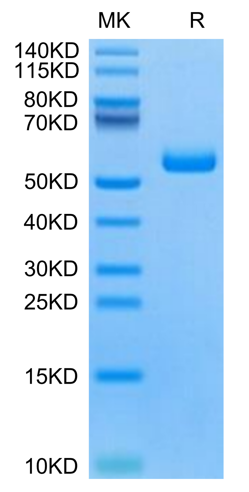 Human TNFRSF19 on Tris-Bis PAGE under reduced condition. The purity is greater than 95%.Recombinant Human TNFRSF19 Protein