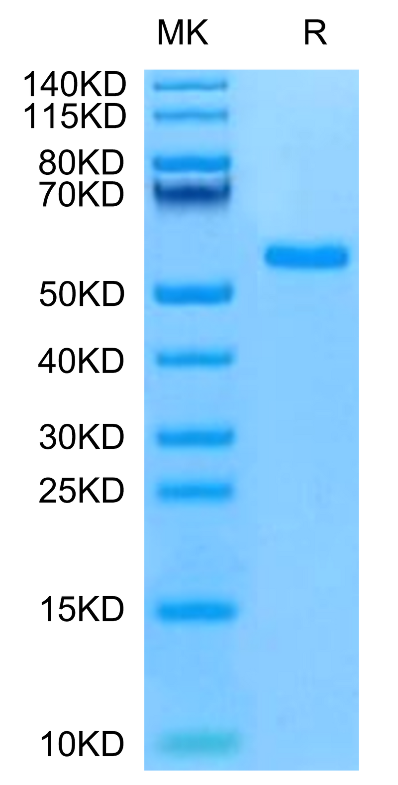 Mouse NKG2C on Tris-Bis PAGE under reduced condition. The purity is greater than 95%.Recombinant Mouse NKG2C/CD159c Protein
