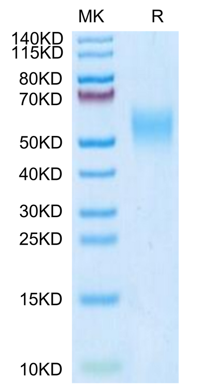 Mouse IL-2 R gamma on Tris-Bis PAGE under reduced condition. The purity is greater than 95%.Recombinant Mouse IL-2 R gamma/CD132 Protein
