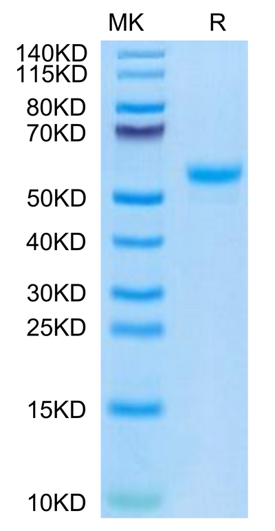 Mouse CPM on Tris-Bis PAGE under reduced condition. The purity is greater than 95%.Recombinant Mouse CPM Protein