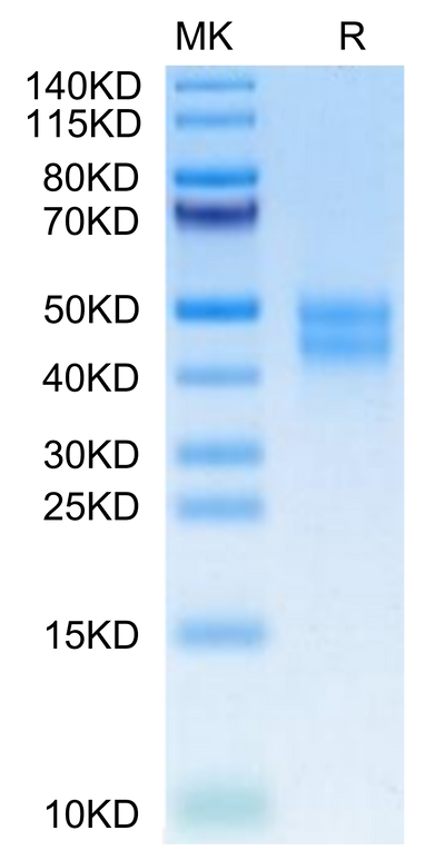 Mouse MXRA8 on Tris-Bis PAGE under reduced condition. The purity is greater than 95%.Recombinant Mouse MXRA8 Protein