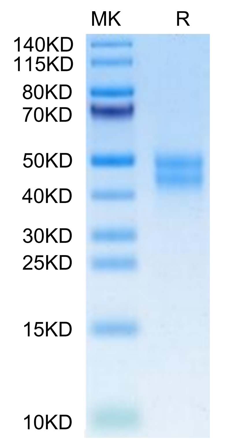Mouse MXRA8 on Tris-Bis PAGE under reduced condition. The purity is greater than 95%.Recombinant Mouse MXRA8 Protein