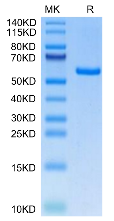 Human EDA2R on Tris-Bis PAGE under reduced condition. The purity is greater than 95%.Recombinant Human EDA2R Protein