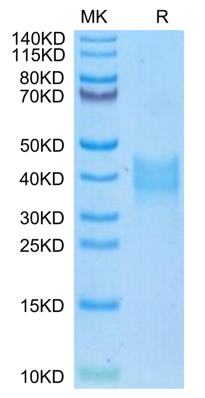 Mouse Oncostatin M on Tris-Bis PAGE under reduced condition. The purity is greater than 95%.Recombinant Mouse Oncostatin M/OSM Protein