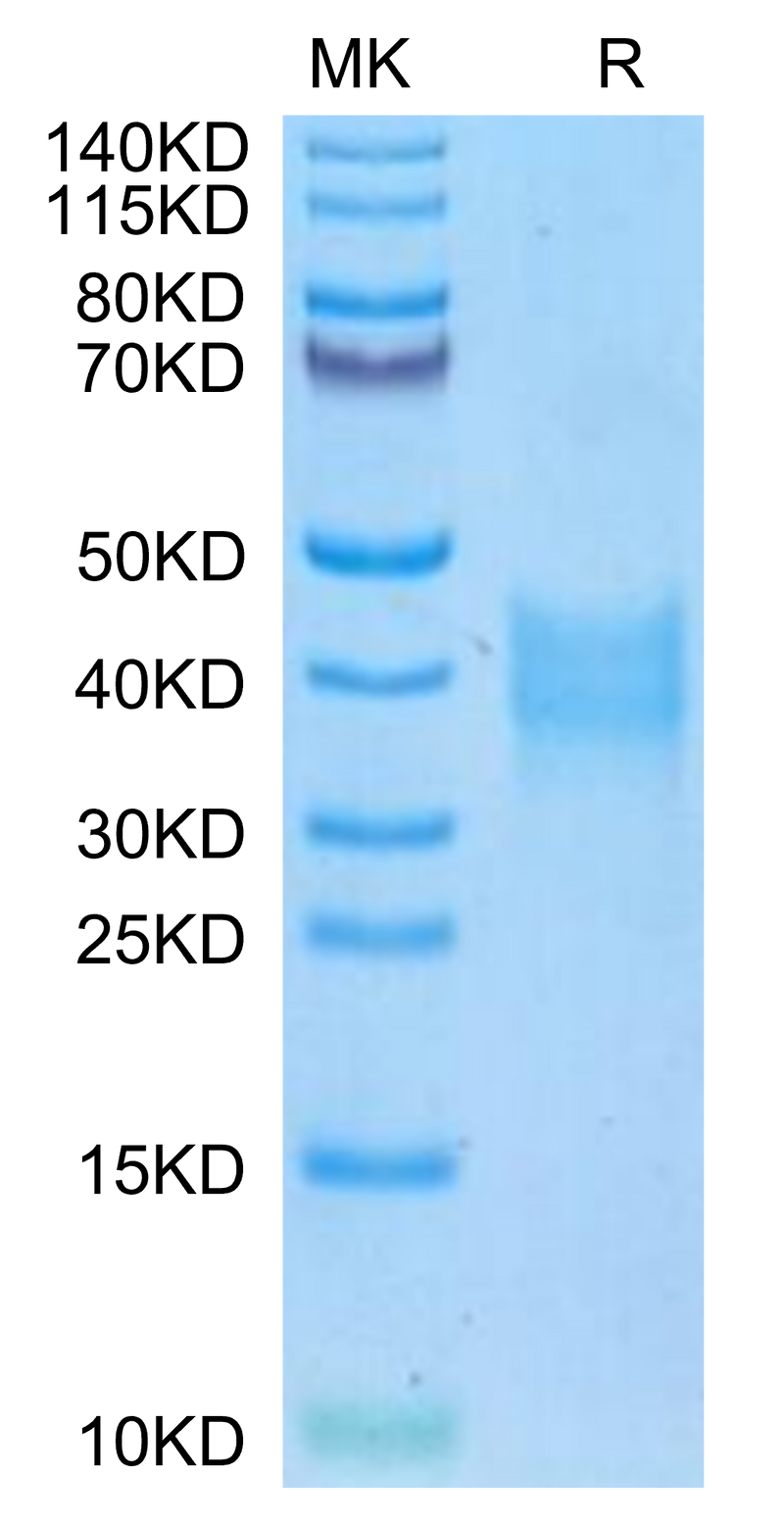 Mouse Oncostatin M on Tris-Bis PAGE under reduced condition. The purity is greater than 95%.Recombinant Mouse Oncostatin M/OSM Protein