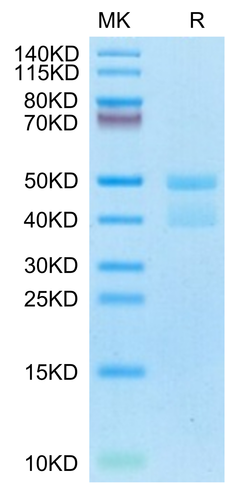 Canine GRP-10 proform on Tris-Bis PAGE under reduced condition. The purity is greater than 95%.Recombinant Canine GRP-10 proform Protein