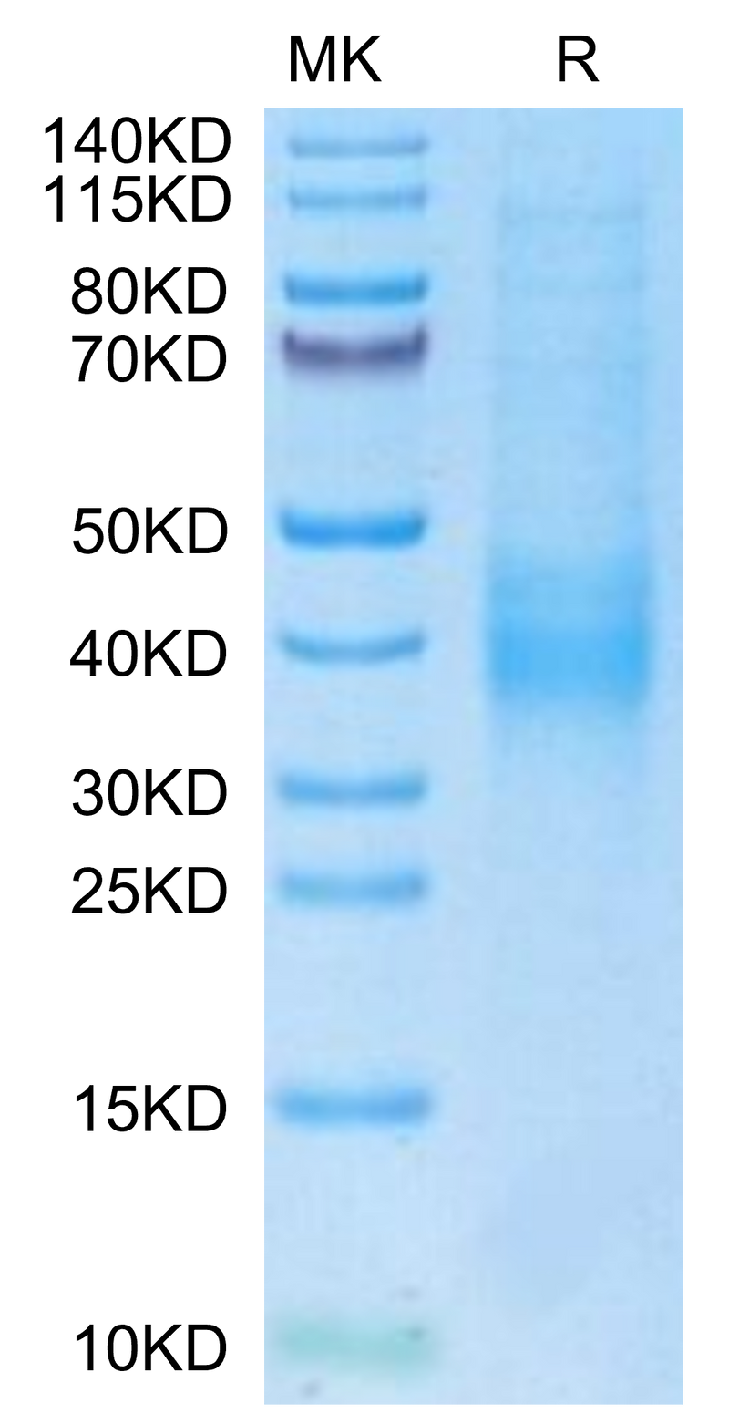 Biotinylated Human NKG2C on Tris-Bis PAGE under reduced condition. The purity is greater than 95%.Biotinylated Human NKG2C/CD159c Protein