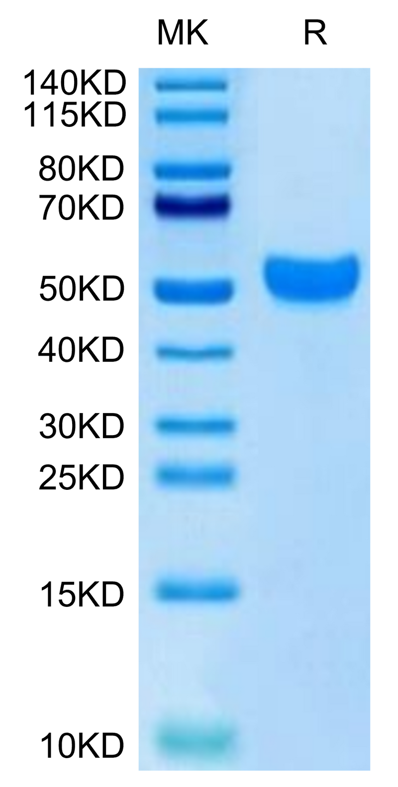 Human NKG2C on Tris-Bis PAGE under reduced condition. The purity is greater than 95%.Recombinant Human NKG2C/CD159c Protein