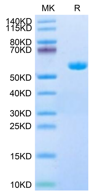Human HLA-A*11:01&B2M&LMP2 (SSCSSCPLTK) Monomer on Tris-Bis PAGE under reduced condition. The purity is greater than 95%.Recombinant Human HLA-A*11:01&B2M&LMP2 (SSCSSCPLTK) Monomer Protein