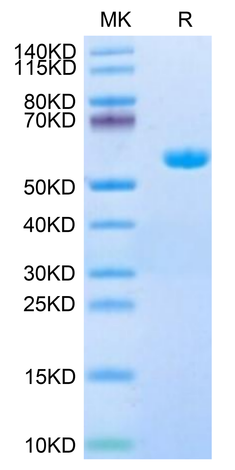 Human HLA-A*11:01&B2M&LMP2 (SSCSSCPLTK) Monomer on Tris-Bis PAGE under reduced condition. The purity is greater than 95%.Recombinant Human HLA-A*11:01&B2M&LMP2 (SSCSSCPLTK) Monomer Protein