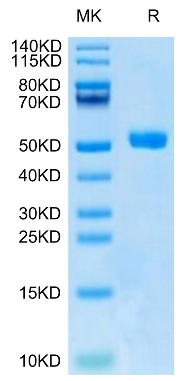 Human DKK1 N terminal Domain on Tris-Bis PAGE under reduced condition. The purity is greater than 95%.Recombinant Human DKK1 N terminal Domain Protein