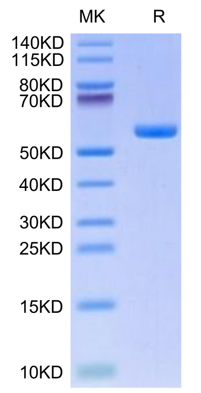 Human HLA-A*11:01&B2M&KRAS G12V (VVGAVGVGK) Monomer on Tris-Bis PAGE under reduced condition. The purity is greater than 95%.Recombinant Human HLA-A*11:01&B2M&KRAS G12V (VVGAVGVGK) Monomer Protein